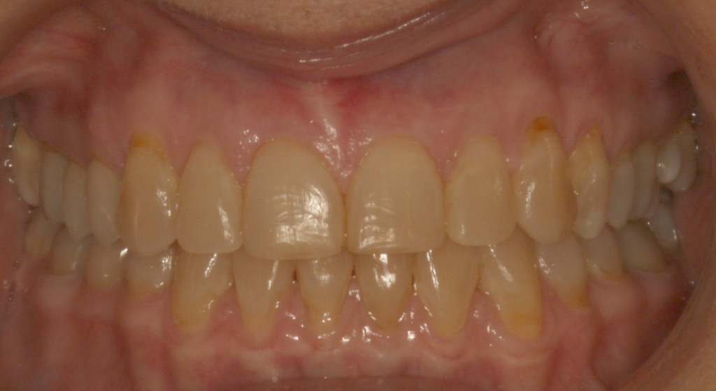 RMitchellFinalFrontal