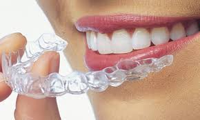 Mckinney Orthodontics clear-aligners 1